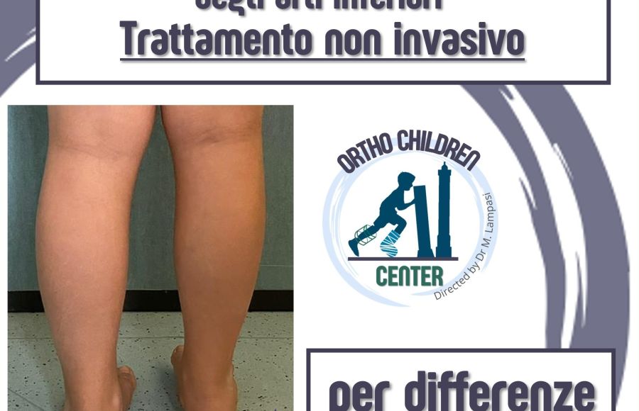 Nuova scheda: trattamento della differenza di lunghezza degli arti inferiori (epifisiodesi simmetrica)
