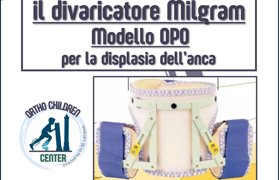 Come applicare il divaricatore Milgram OPO per la displasia dell’anca