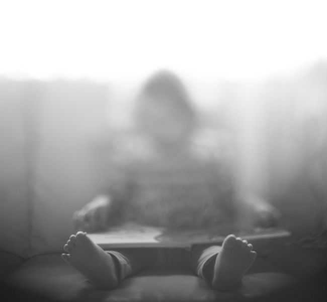 Lussazione congenita anca